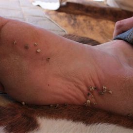 The Scourge of Ranch Life